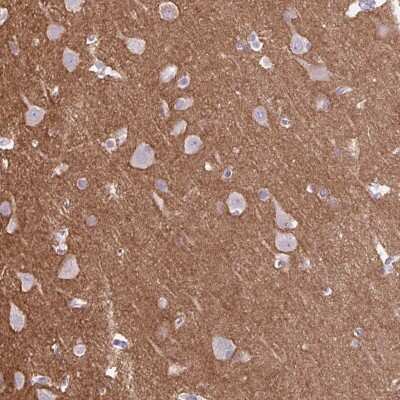 Immunohistochemistry-Paraffin: DPP6 Antibody [NBP2-47481]