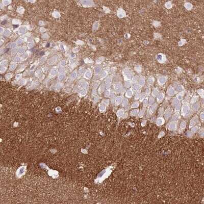 Immunohistochemistry-Paraffin: DPP6 Antibody [NBP2-47481]