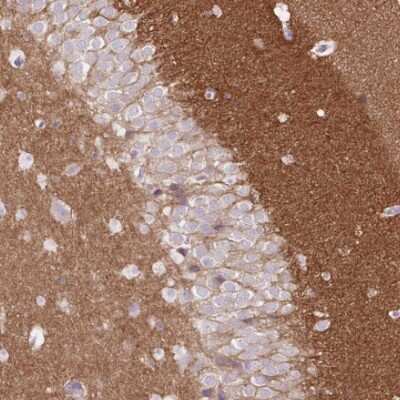 Immunohistochemistry-Paraffin: DPP6 Antibody [NBP2-47481]
