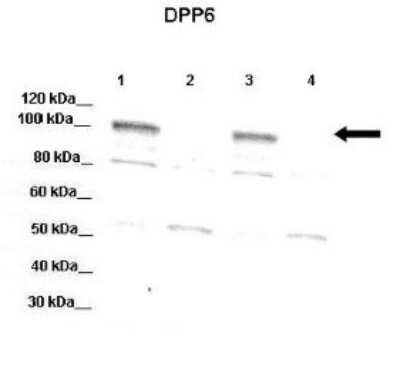 Western Blot: DPP6 Antibody [NBP1-59427]