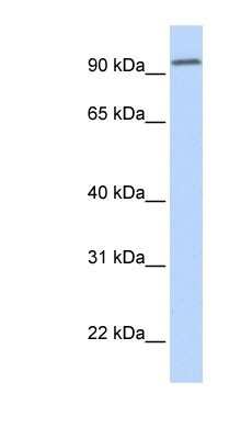 Western Blot: DPP6 Antibody [NBP1-59925]