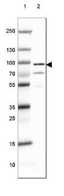 Western Blot: DPP6 Antibody [NBP2-47481]