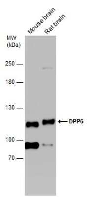 Western Blot: DPP6 Antibody [NBP3-13212]