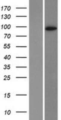 Western Blot: DPP6 Overexpression Lysate [NBP2-08163]