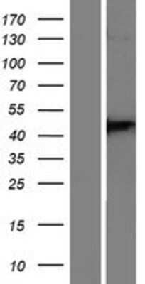 Western Blot: DPP6 Overexpression Lysate [NBP2-08568]