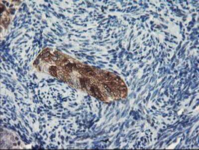 Immunohistochemistry-Paraffin: DPP8 Antibody (OTI1D2) [NBP2-01830]