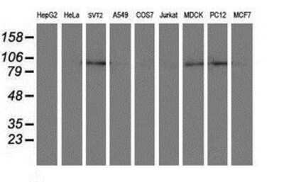 Western Blot: DPP8 Antibody (OTI1D2) [NBP2-01830]