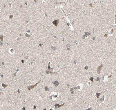 Immunohistochemistry-Paraffin: DPP8 Antibody [NBP1-84993]