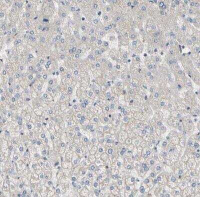 Immunohistochemistry-Paraffin: DPP8 Antibody [NBP1-84993]