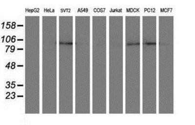 Western Blot: DPP8 Antibody (OTI1D2)Azide and BSA Free [NBP2-71972]