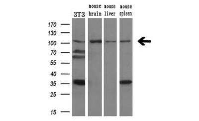 Western Blot: DPP8 Antibody (OTI1D2) [NBP2-01830]