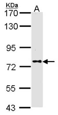 Western Blot: DPP8 Antibody [NBP1-31256]