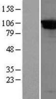 Western Blot: DPP8 Overexpression Lysate [NBL1-09999]