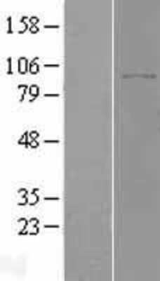 Western Blot: DPP8 Overexpression Lysate [NBL1-10000]