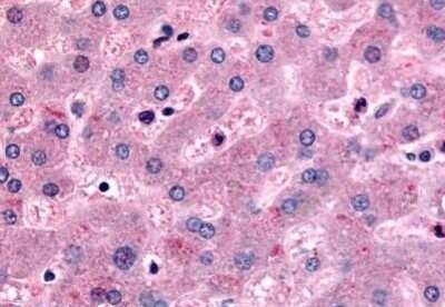 Immunohistochemistry-Paraffin: DPP9 Antibody - BSA Free [NB100-59032]