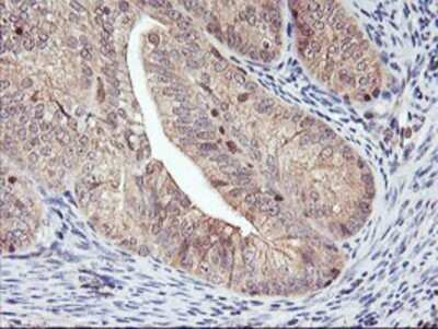 Immunohistochemistry: DPP9 Antibody (OTI2E3) - Azide and BSA Free [NBP2-72318]