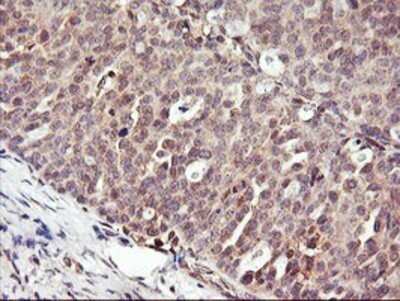 Immunohistochemistry: DPP9 Antibody (OTI2E3) - Azide and BSA Free [NBP2-72318]