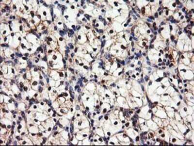Immunohistochemistry: DPP9 Antibody (OTI2E3) - Azide and BSA Free [NBP2-72318]
