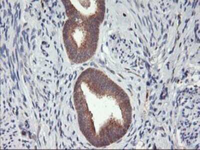 Immunohistochemistry: DPP9 Antibody (OTI2E3) - Azide and BSA Free [NBP2-72318]
