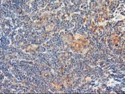 Immunohistochemistry: DPP9 Antibody (OTI2E3) - Azide and BSA Free [NBP2-72318]