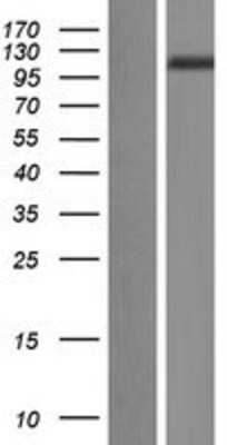 Western Blot: DPP9 Overexpression Lysate [NBL1-10001]