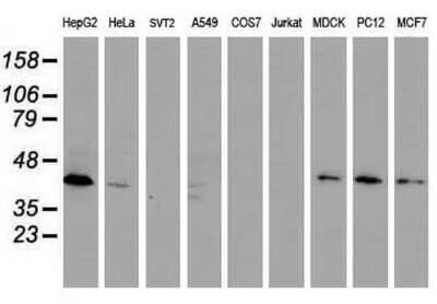 Western Blot: DPPA2 Antibody (OTI1G10)Azide and BSA Free [NBP2-72426]