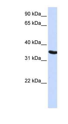 Western Blot: DPPA2 Antibody [NBP1-54631]