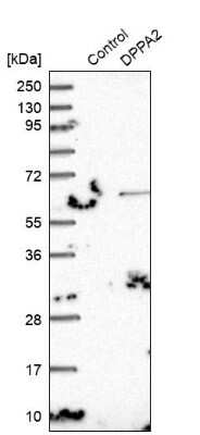 Western Blot: DPPA2 Antibody [NBP1-85426]