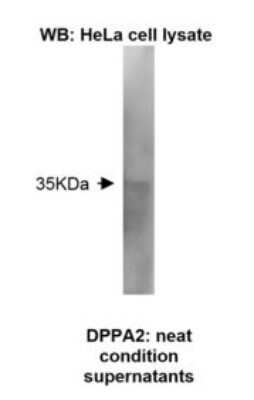 Western Blot: DPPA2 Antibody (Z31P3C4*F11)BSA Free [NBP2-50230]