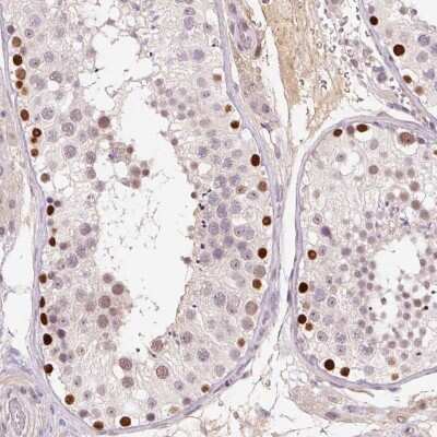Immunohistochemistry-Paraffin: DPPA4 Antibody [NBP2-48633]