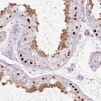 Immunohistochemistry-Paraffin: DPPA4 Antibody [NBP2-48634]