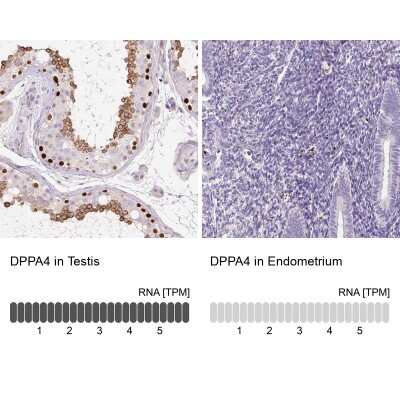 Immunohistochemistry-Paraffin: DPPA4 Antibody [NBP2-48634]