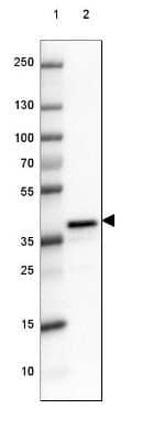 Western Blot: DPPA4 Antibody [NBP2-48634]