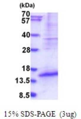 SDS-PAGE: Recombinant Human DPPA5/ESG1 His Protein [NBP2-51909]