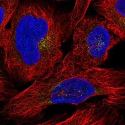 Immunocytochemistry/ Immunofluorescence: DPPII/QPP/DPP7 Antibody [NBP2-55799]