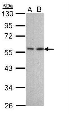 Western Blot: DPPII/QPP/DPP7 Antibody [NBP1-32875]