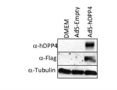 Western Blot: DPPIV/CD26 Antibody (OTI11D7) [NBP2-02154]