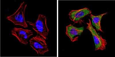 Immunocytochemistry/ Immunofluorescence: DPPIV/CD26 Antibody (236.3) - Azide and BSA Free [NBP2-22434]