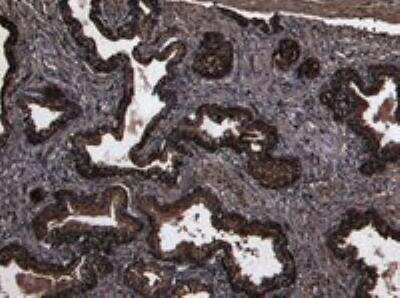 Immunohistochemistry-Paraffin: DPPIV/CD26 Antibody [NB100-61658]