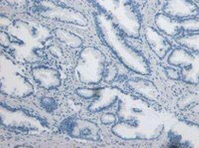 Immunohistochemistry-Paraffin: DPPIV/CD26 Antibody [NB100-61658]