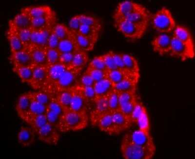 Immunocytochemistry/ Immunofluorescence: DPPIV/CD26 Antibody (JM11-42) [NBP2-78791]