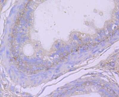 Immunohistochemistry-Paraffin: DPPIV/CD26 Antibody (JM11-42) [NBP2-78791]