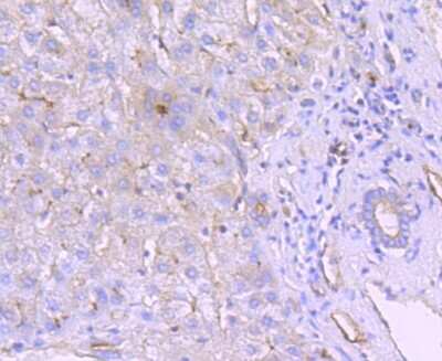 Immunohistochemistry-Paraffin: DPPIV/CD26 Antibody (JM11-42) [NBP2-78791]