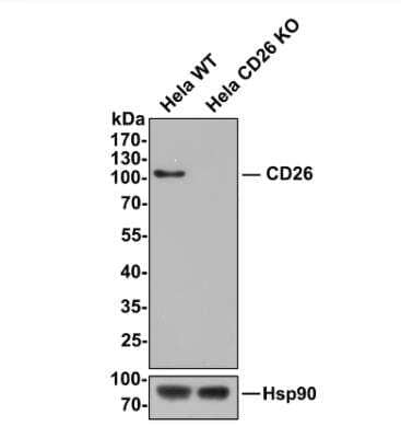 Knockout Validated: DPPIV/CD26 Antibody (JM11-42) [NBP2-78791]