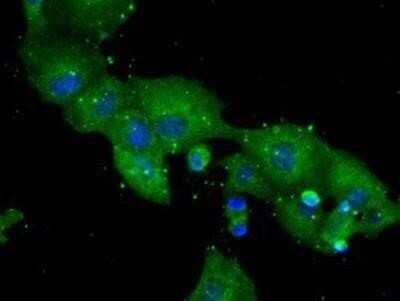Immunocytochemistry/ Immunofluorescence: DPPIV/CD26 Antibody (OTI11D7) - Azide and BSA Free [NBP2-70588]