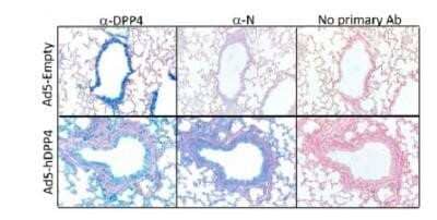 Immunohistochemistry: DPPIV/CD26 Antibody (OTI11D7) - Azide and BSA Free [NBP2-70588]