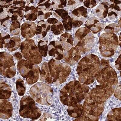 Immunohistochemistry-Paraffin: DPRX Antibody [NBP1-91847]