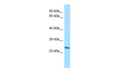 Western Blot: DPRX Antibody [NBP2-82918]