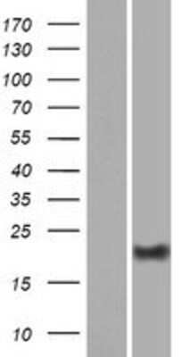 Western Blot: DPRX Overexpression Lysate [NBP2-08688]