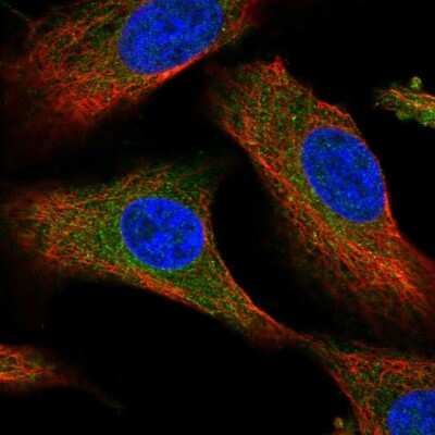 Immunocytochemistry/ Immunofluorescence: DPS Antibody [NBP2-55185]